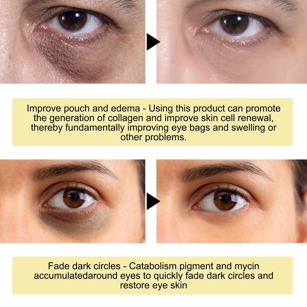 Gold Snail Collagen Eye Mask.